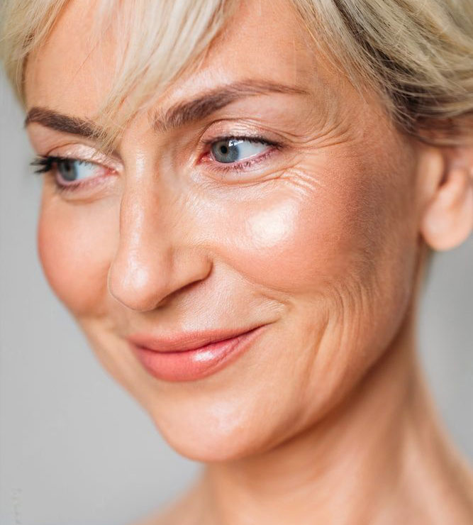 What is a Facelift? (female photo)